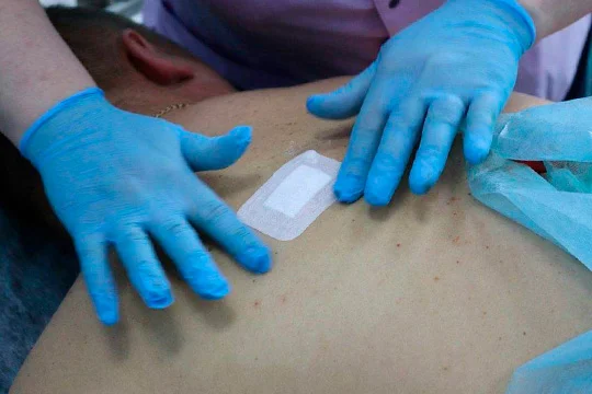 Процедура вшивания